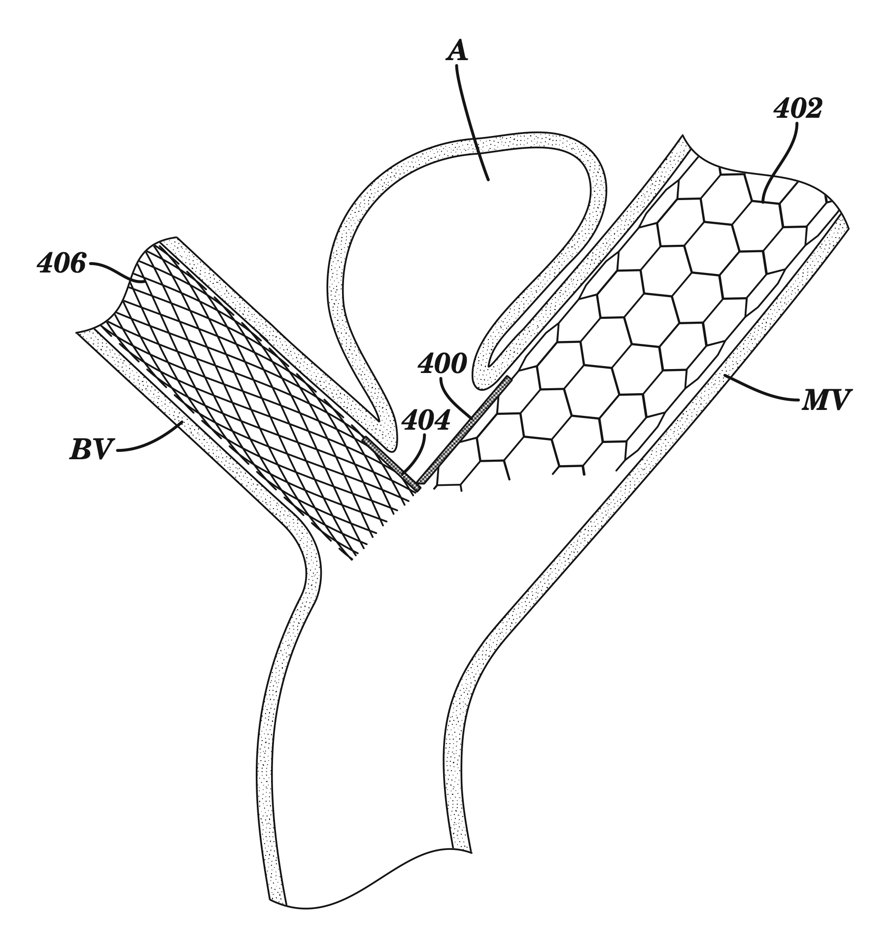 20_ptiserviceco_patent_drawing_biotechnology.png